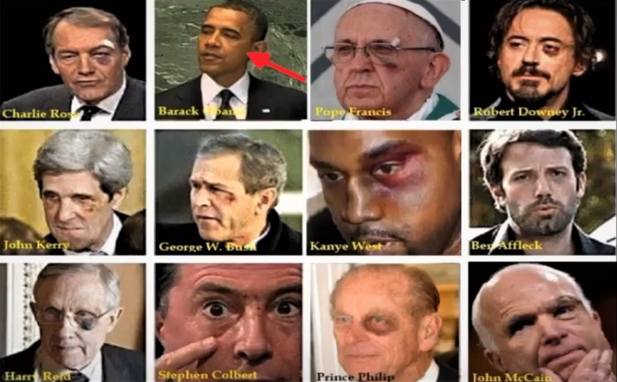 “Black Eye Club” Forever Victims Of The Globalist Cabal (Must See Video)